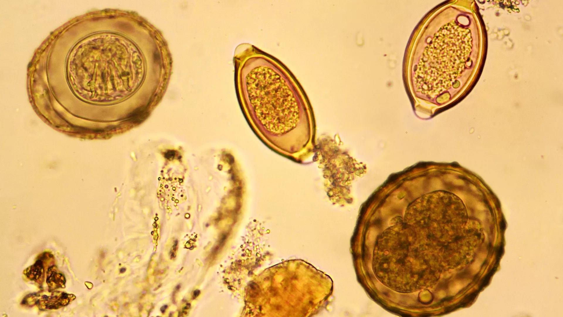 Frontiers In Parasitology Parasite Diagnostics